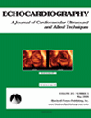 ECHOCARDIOGRAPHY