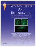 Wound Repair and Regeneration